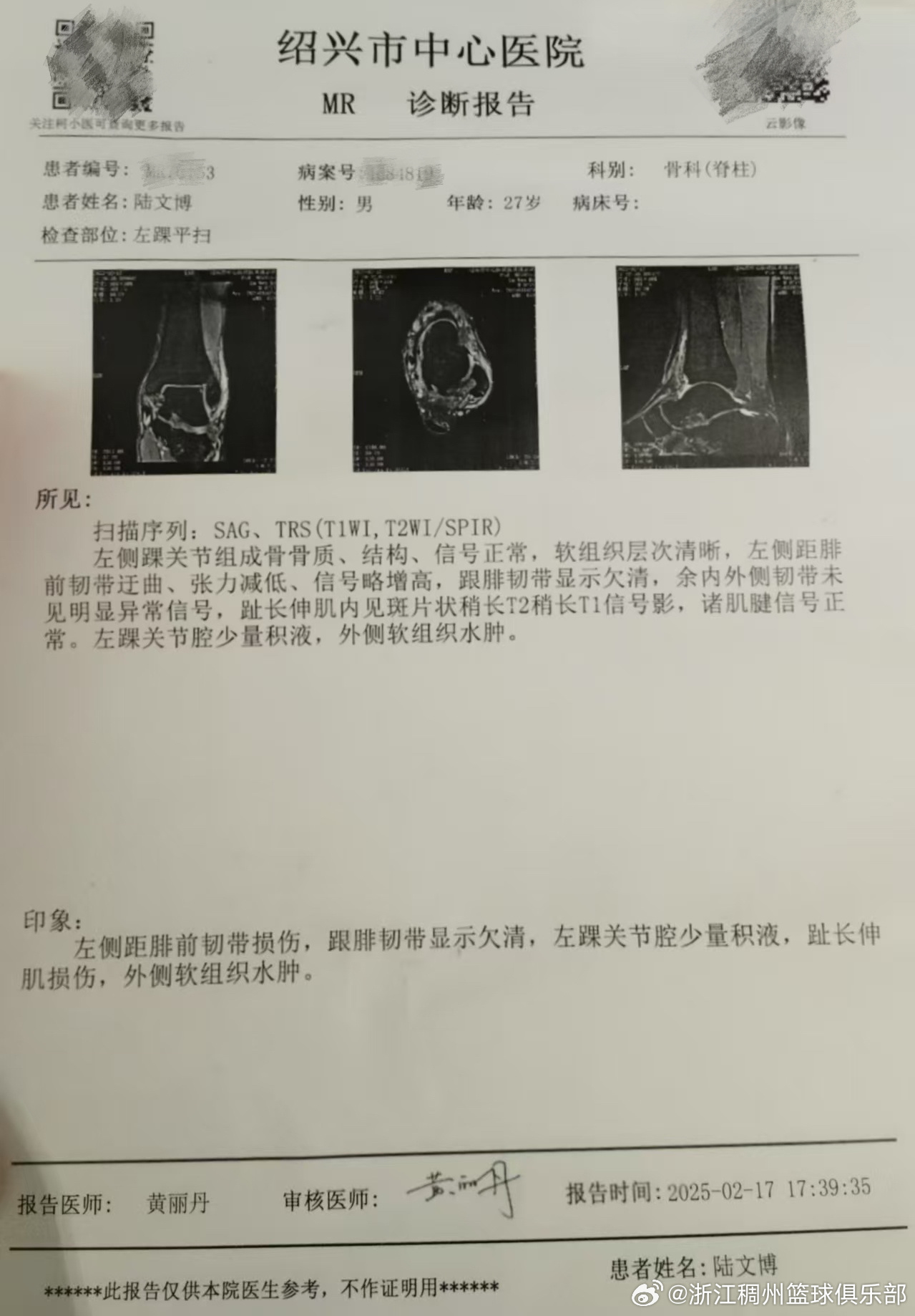 詹姆斯通过